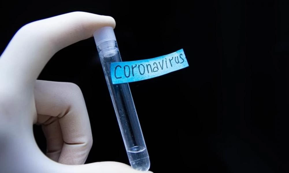 Κορονοϊός - Η Κύπρος παρέλαβε χλωροκίνη στα..κρυφά